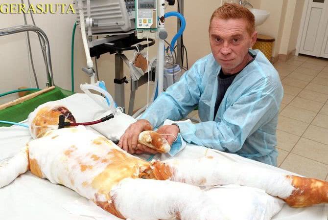 На Николаевщине чудом выжившего после удара током 9-летнего сына родители бросили в больнице