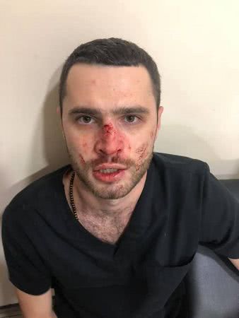 В Николаеве директор стоматологического центра разбил нос своему бывшему сотруднику, чтобы не платить долг по зарплате