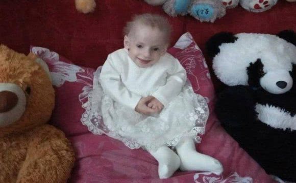 В Украине 8-летняя девочка умерла от преждевременного старения
