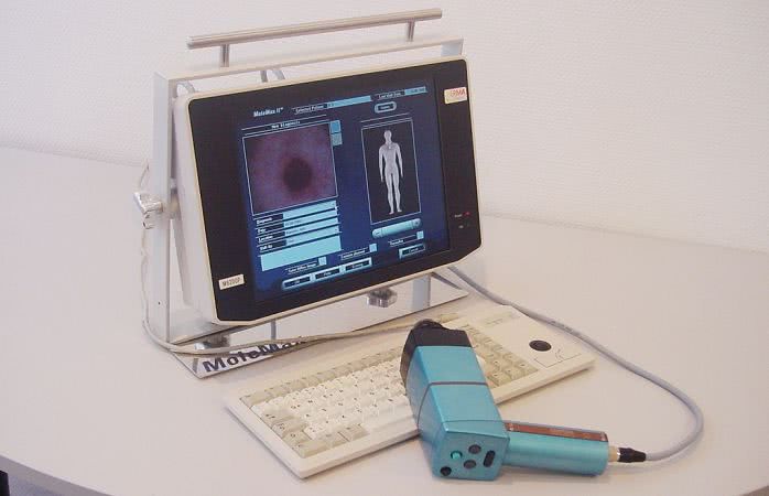Цифровую дерматоскопическую систему закупят в Николаевский областной центр онкологии