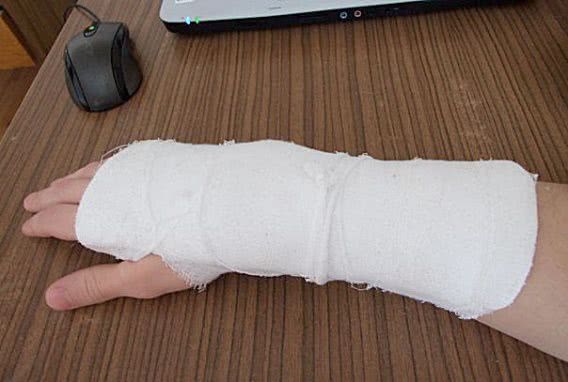 В Николаеве хулиган с одного удара сломал руку полицейскому