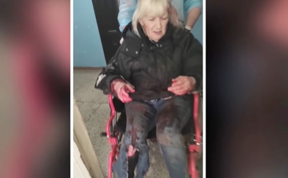 На Николаевщине бешеный пес порвал женщину